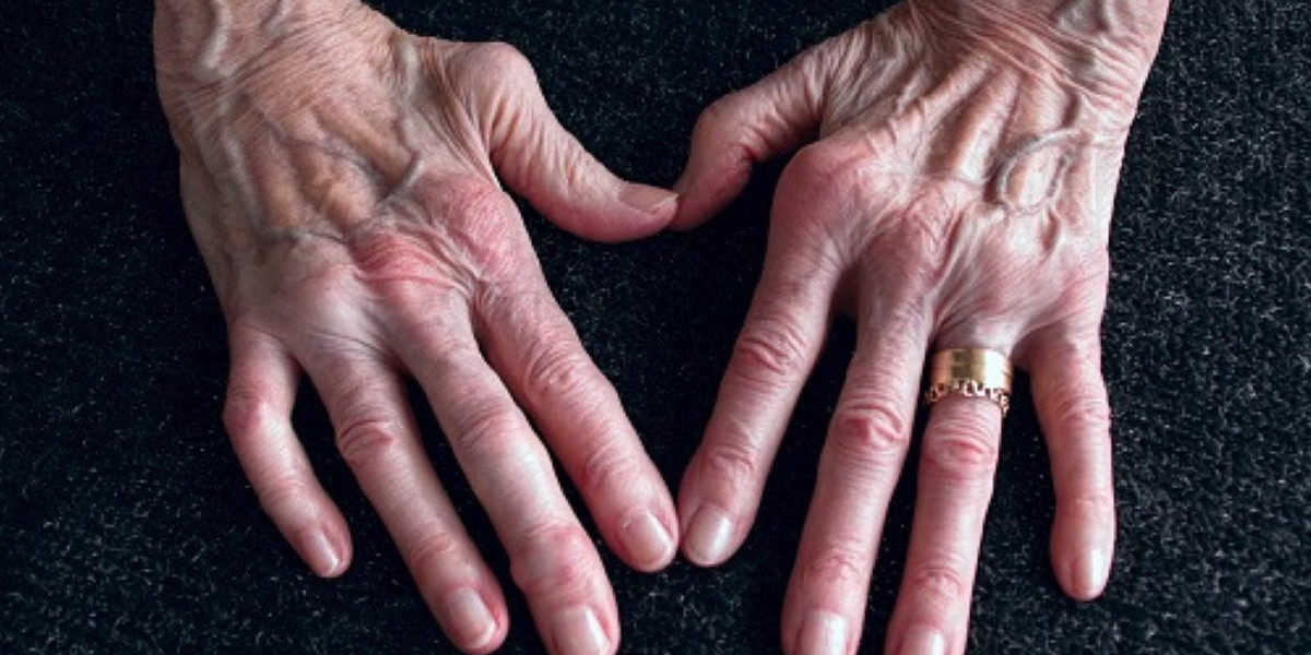10 Tips for Decoding Rheumatoid Arthritis Pain