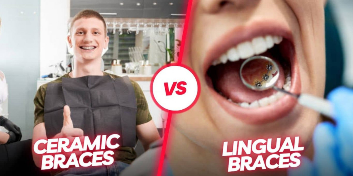Transforming Smiles: Before and After with Lingual Braces