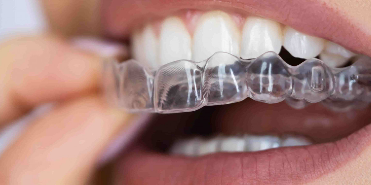 Clear Aligners: The Future of Orthodontic Treatment in Dubai