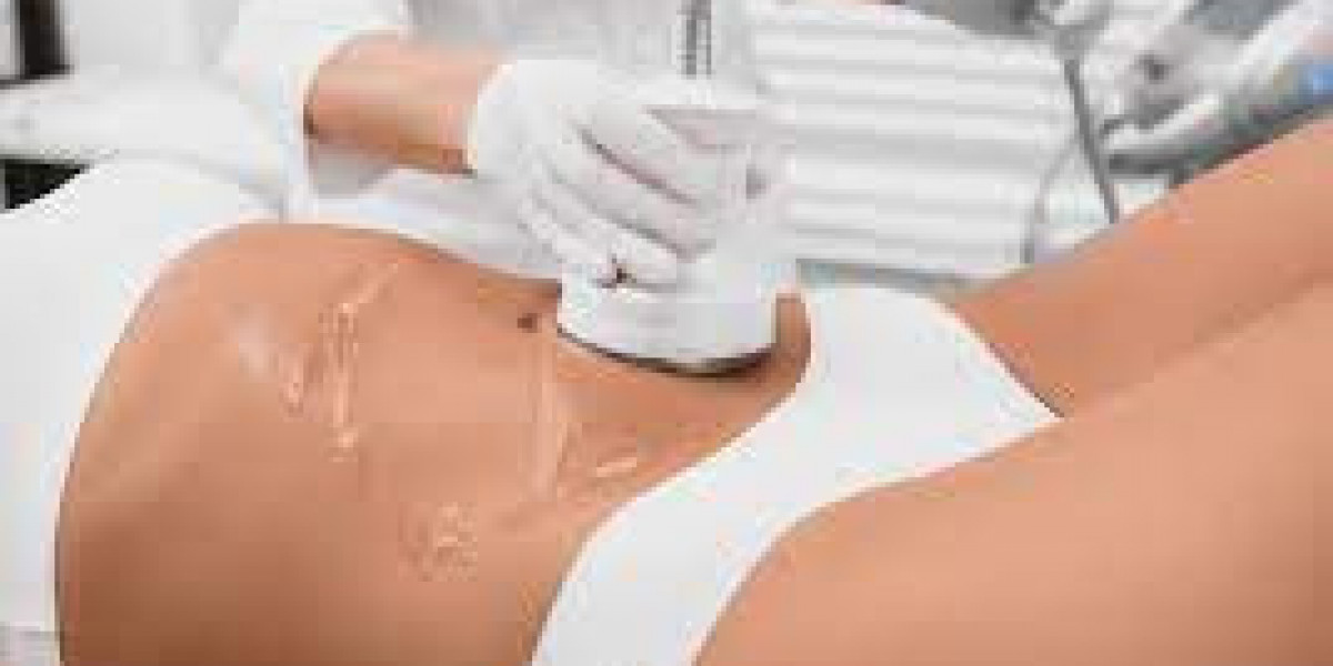 What is the fastest way to recover from Body Jet Liposuction In Dubai?