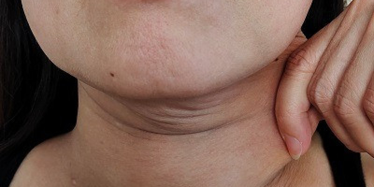 Double Chin: Can Massage Help in Reduction?