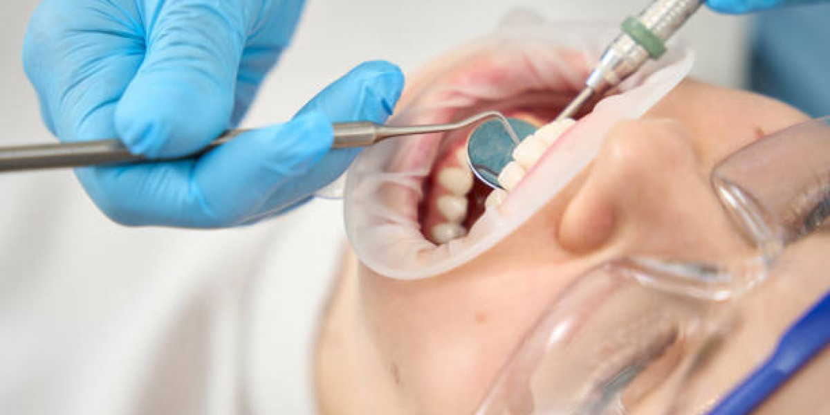 Hosting a Root Canal Awareness Event at Your Practice