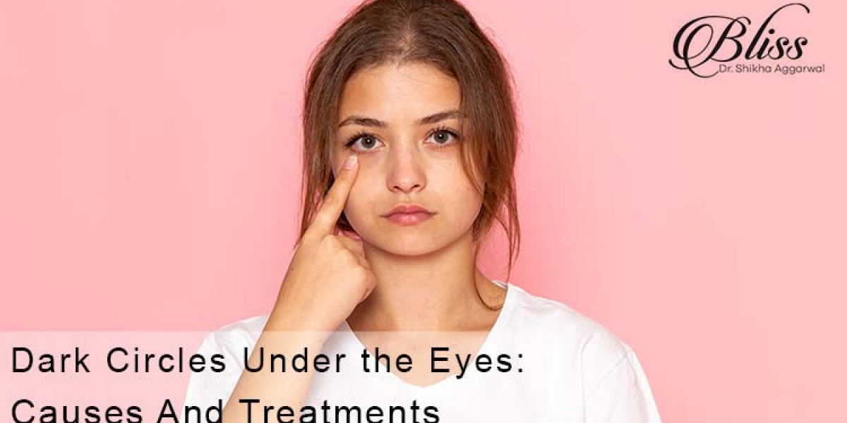 How to Get Rid of Dark Circles Under the Eyes? Expert Tips