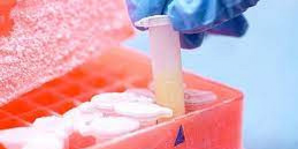 Cryopreservation Cell Lines Market Size, Growing Trends and Industry Demand