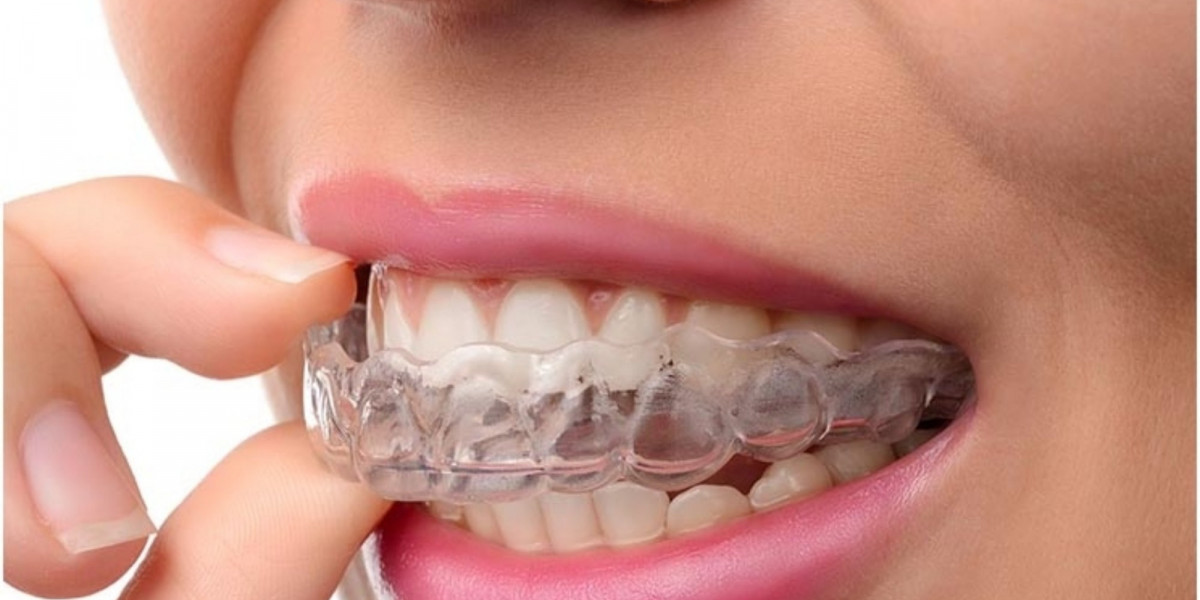 Confidence in Every Smile: Clear Aligners Now Accessible in Dubai