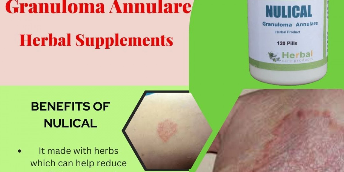 Granuloma Annulare Causes, Symptoms, Natural Remedies