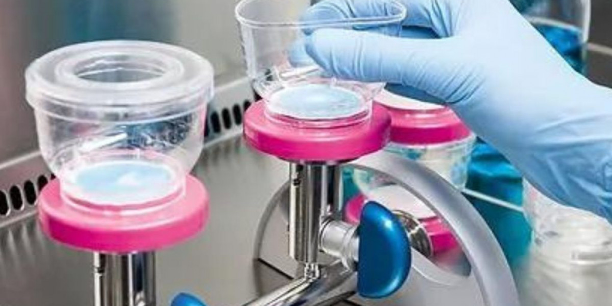 Bioburden Testing Market Report 2024: Analysis, Share, Outlook, Growth, & Forecast 2032