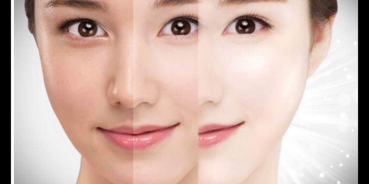 Experience Brighter Skin with Whitening Treatments in Dubai