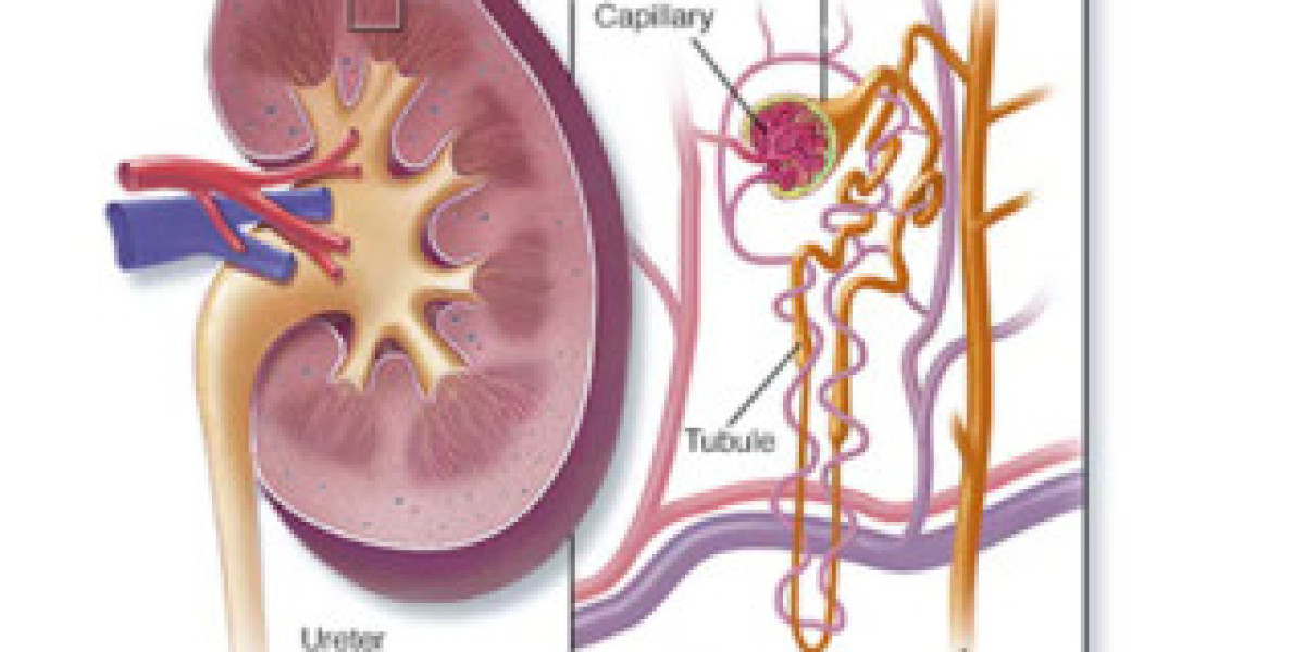 How to prevent acute kidney failure?