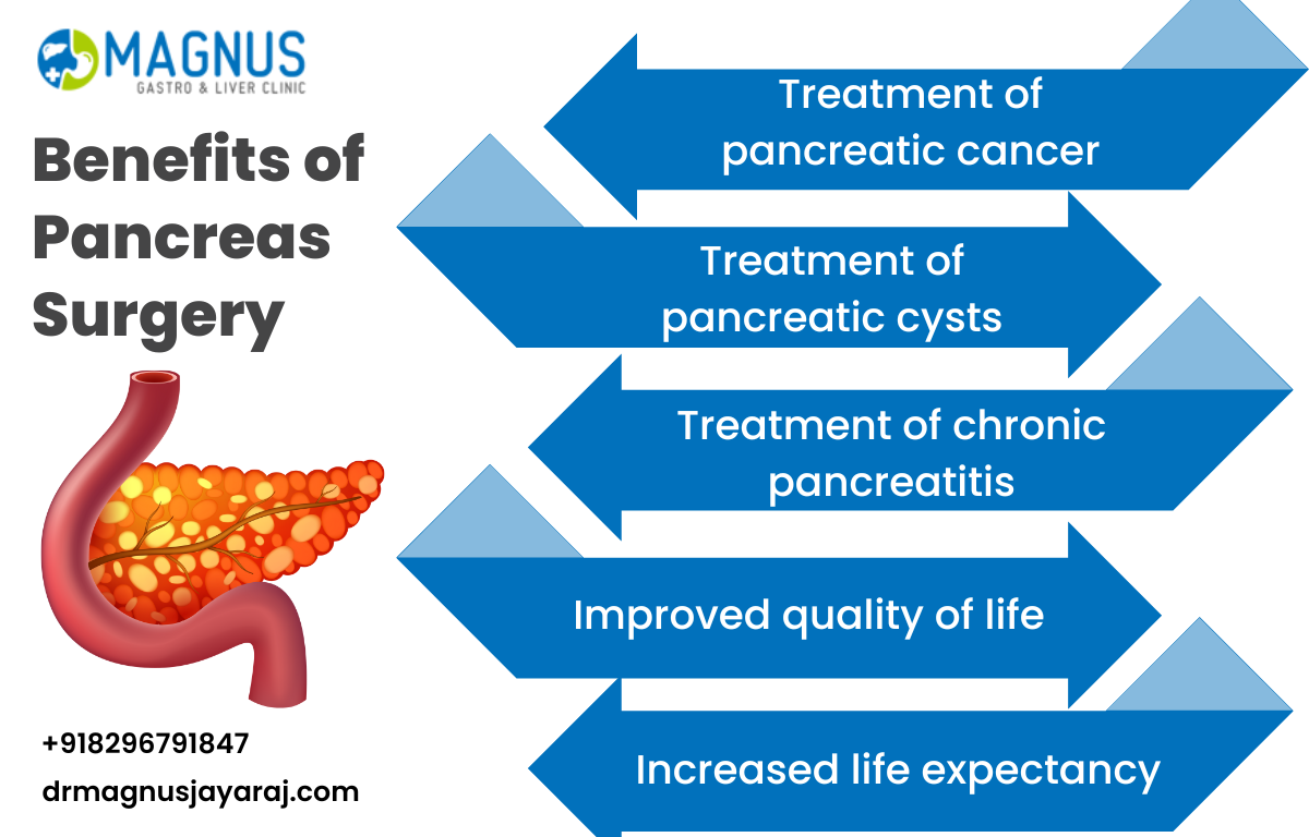 pancreas surgery in Chennai