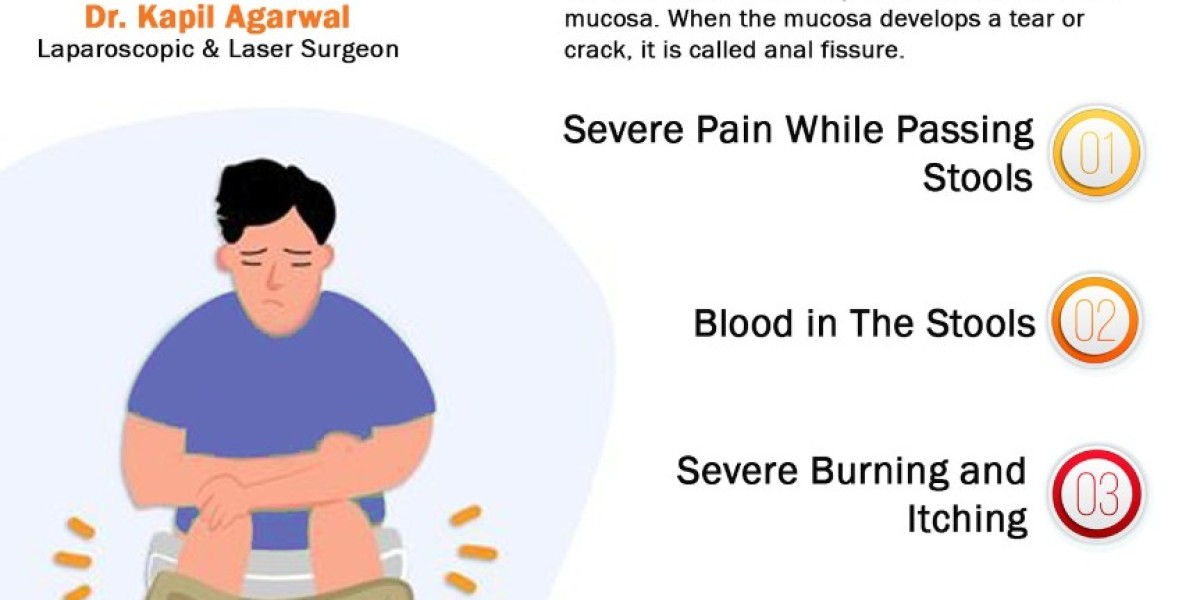 Anal Fissure Surgery: A Comprehensive Guide