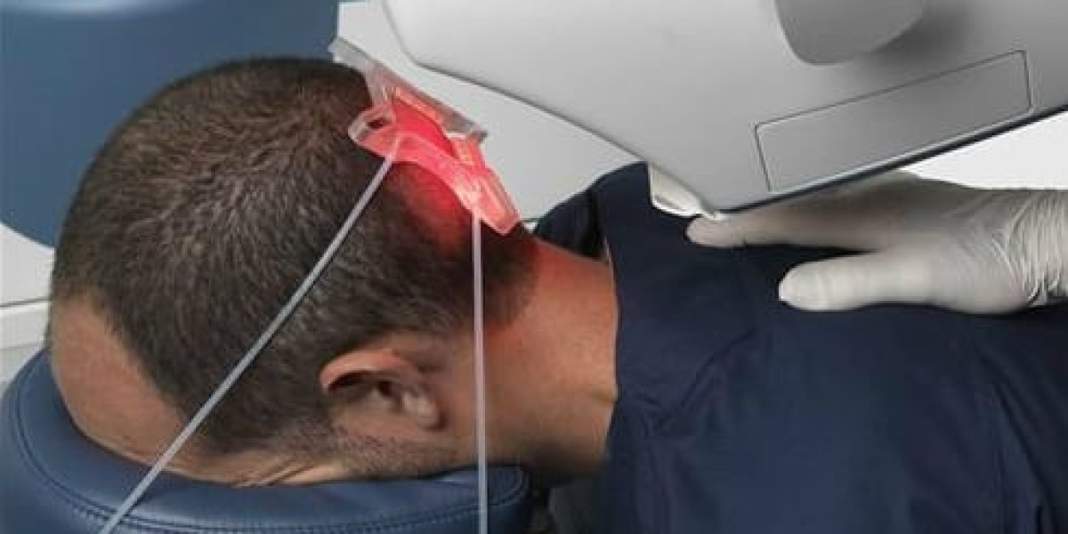 Robotic Hair Transplant Costs in Dubai: What You Should Know