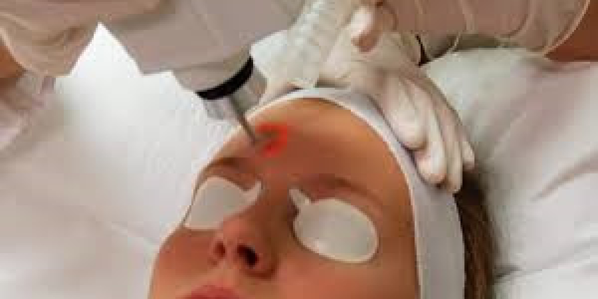 How to Find the Best Laser Treatment in Dubai