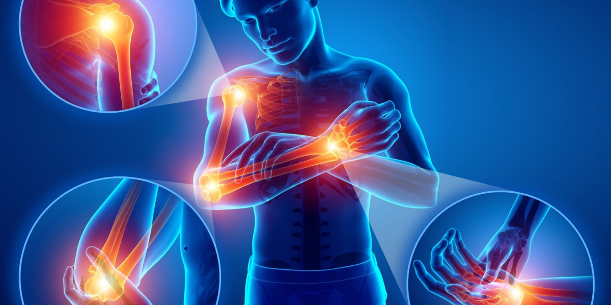 Nerve Pain and Its Impact on Quality of Life