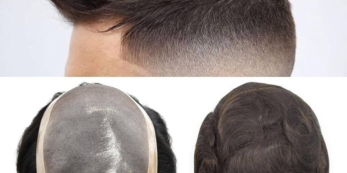 Mens hair systems - perfect for the innovative style!