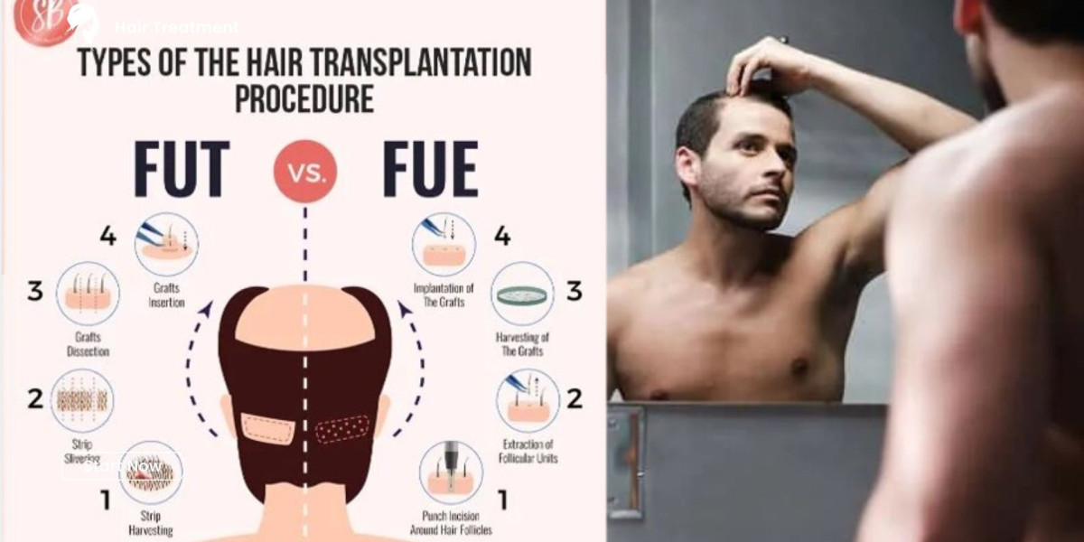 How Long Does Recovery After a Hair Transplant Take?