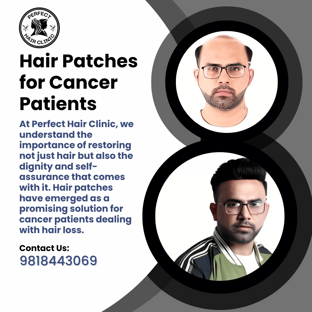 Hair Patches for Cancer Patients| Hair Loss Solution in Delhi NCR