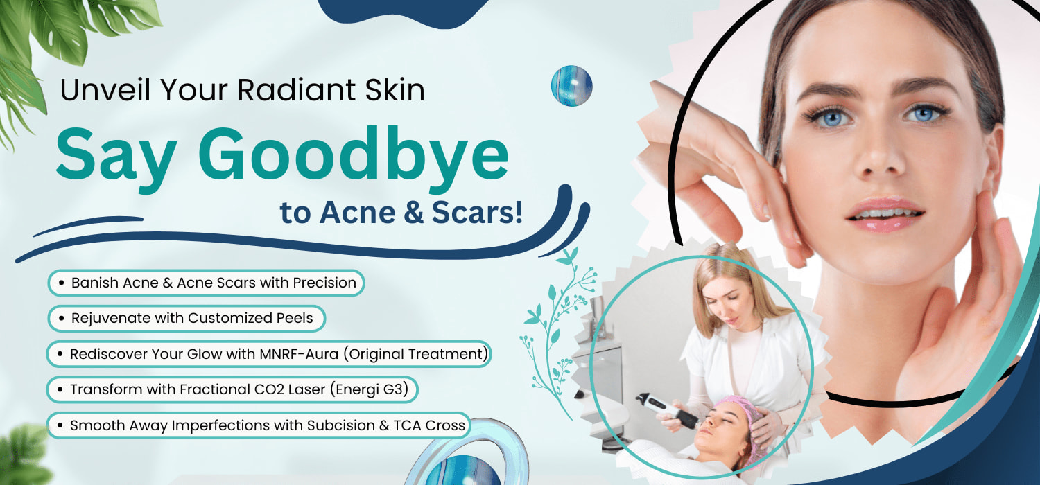 Best Acne Scar Treatment in Jalandhar with Affordable Prices - Dr Shivani's Skin Clinic