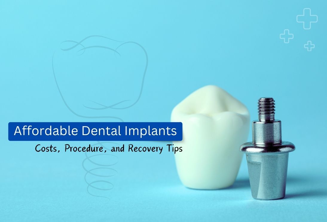 Affordable Dental Implants: Costs, Procedure, and Recovery Tips | Teethcare