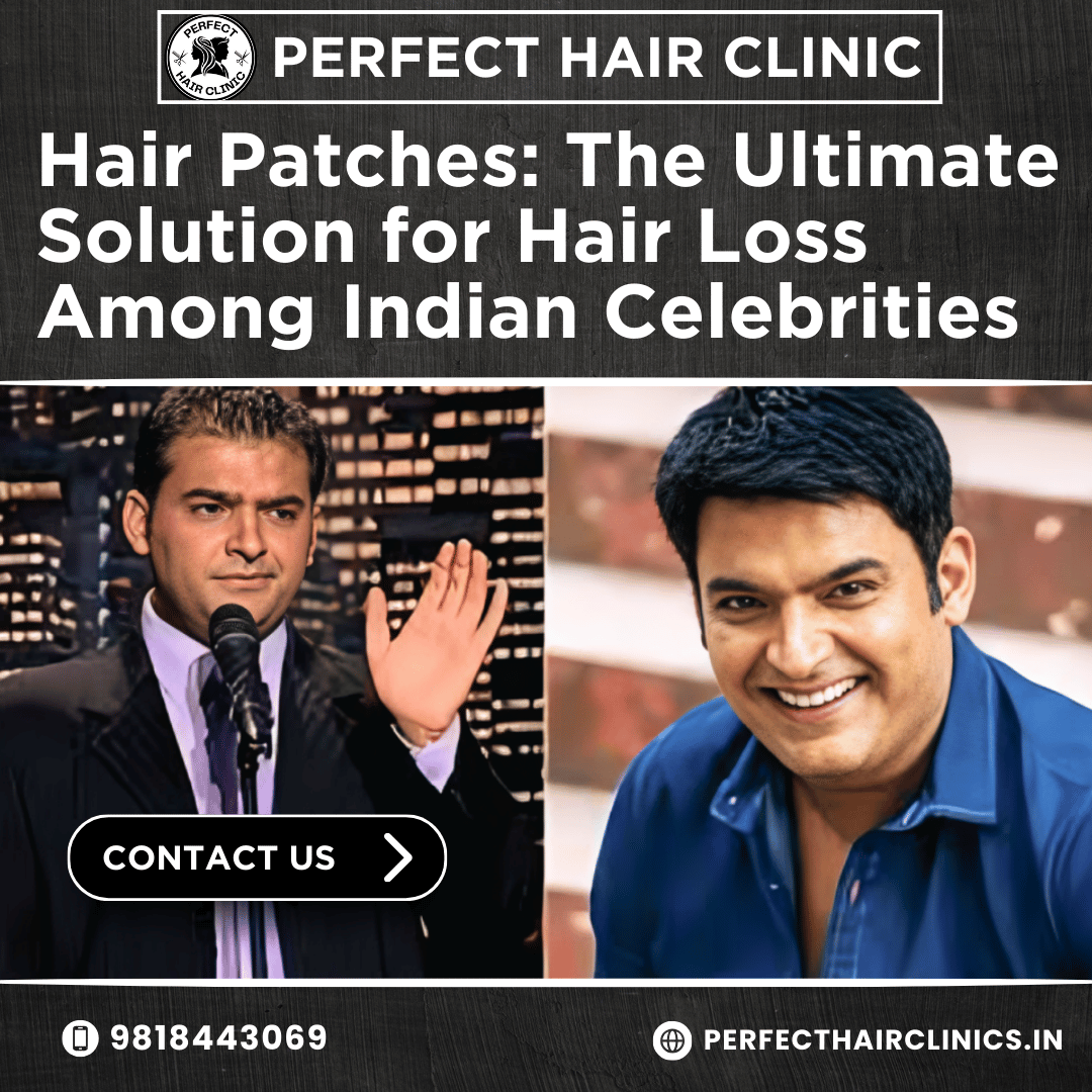 The Ultimate Solution for Hair Loss Among Indian Celebrities