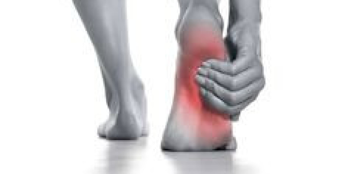 Struggling with Plantar Fasciitis? Discover Relief with Massage Therapy in Surrey