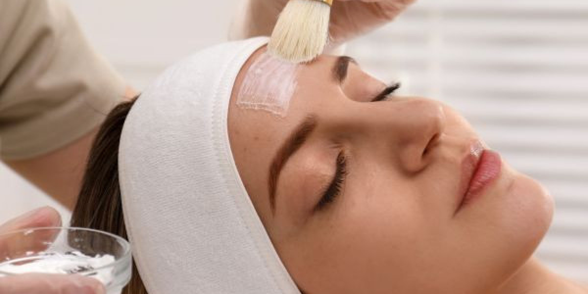 Chemical Peels for Neck and Décolletage: Is It Possible?