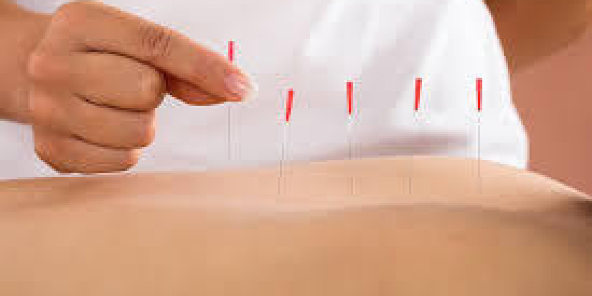 Acupuncture for Women's Health and Gynecological Conditions