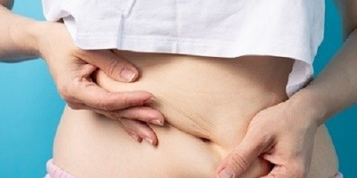 Is Liposuction Painful, and What’s the Recovery Time?