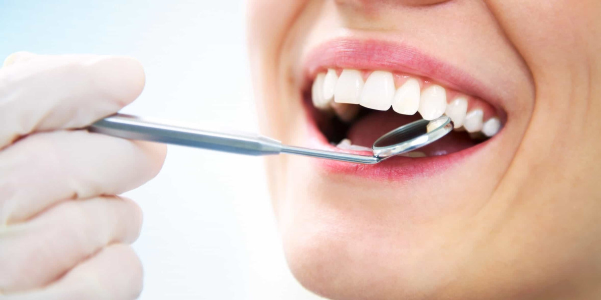 Tooth Extractions: Everything You Need to Know