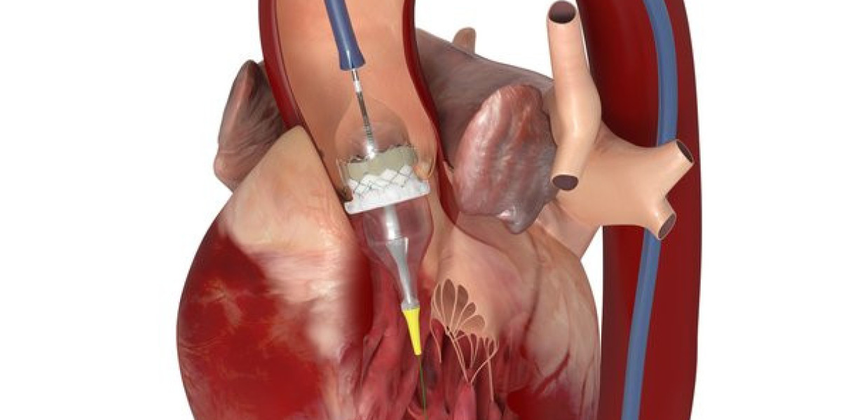 Transcatheter Aortic Valve Replacement Market driven by rising prevalence of aortic stenosis