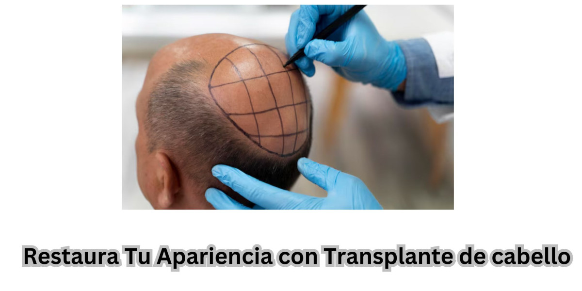 Restaura Tu Apariencia con un Transplante de cabello