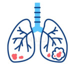 Lung Cancer Treatment Hospitals in Bangalore Profile Picture