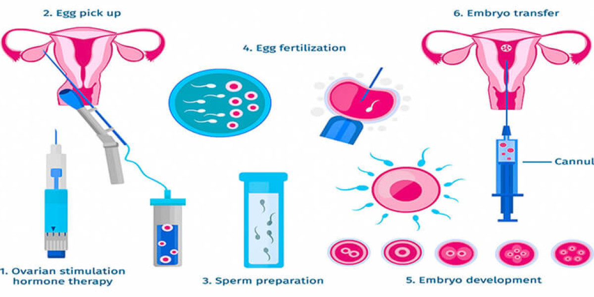 Understanding IVF Treatment and Test Tube Baby Procedures at Australian Concept Infertility in Pakistan