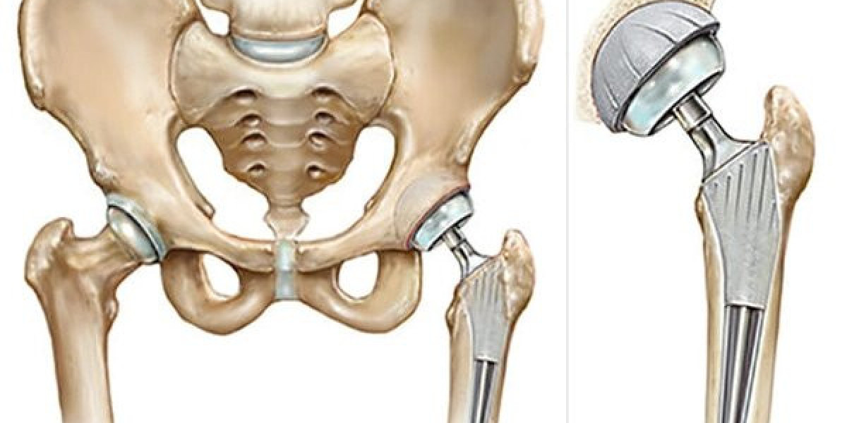 Best Knee and hip replacement doctor in Rajasthan