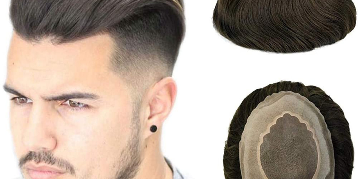 Wig Options - Hair systems for men