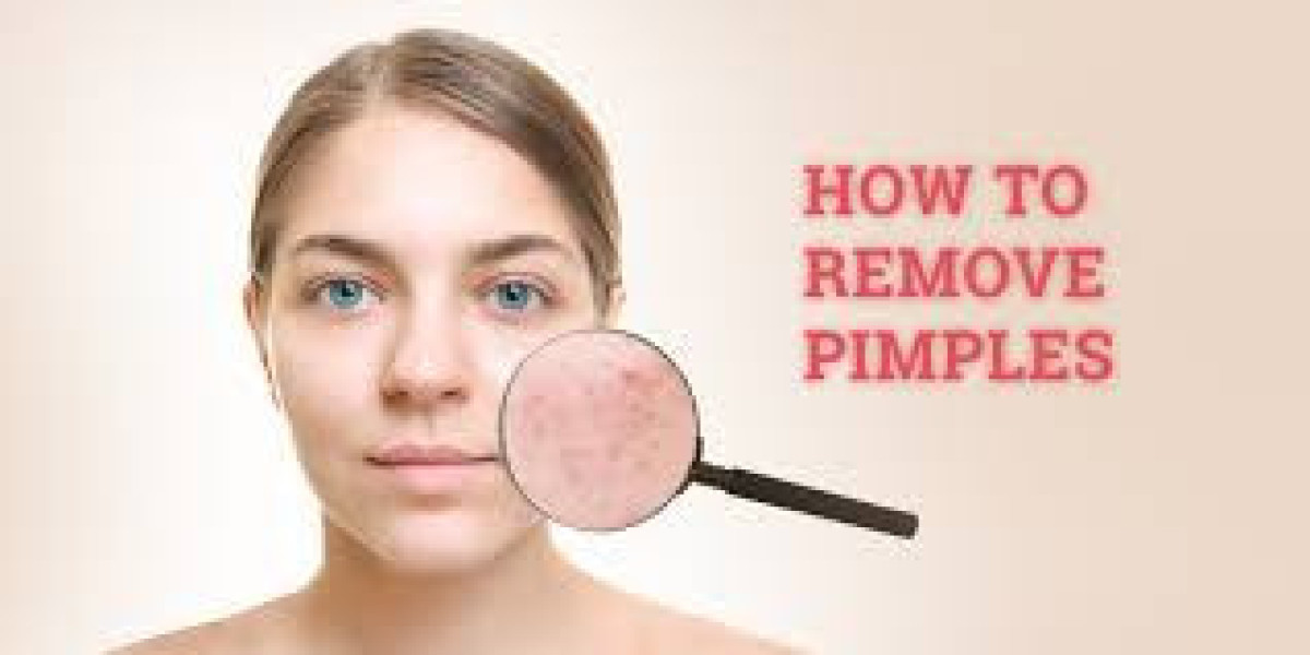 How to Get Rid of Pimple Marks: Effective Treatments and Tips for Clear Skin