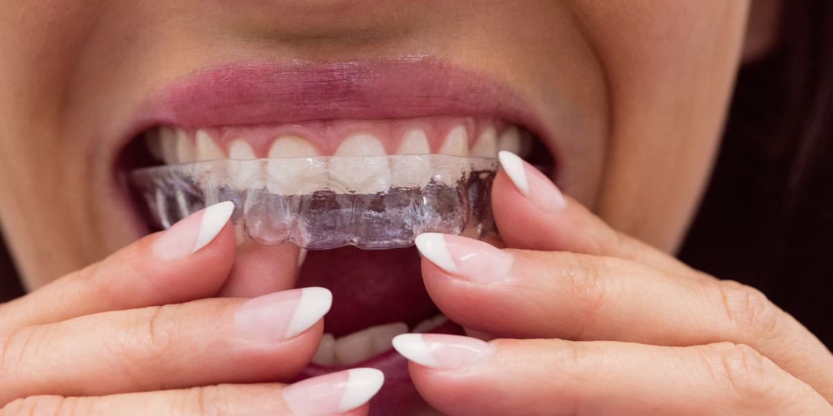 Top 5 Benefits of Choosing Invisalign for Adults in Montreal