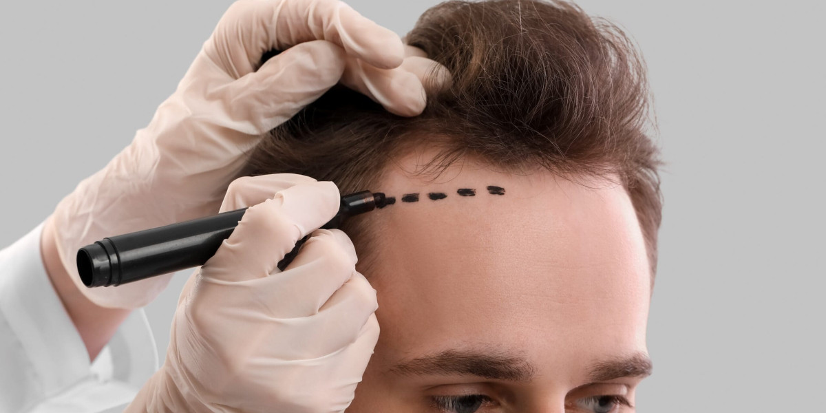 The Connection Between Scalp Health and Hair Growth