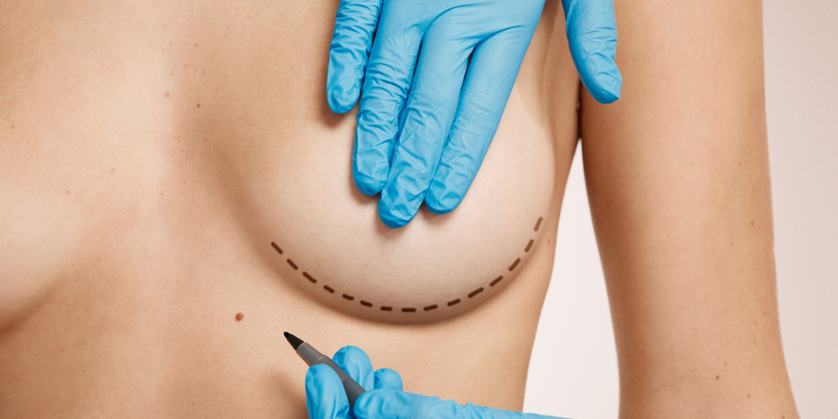 What to expect after your breast reduction surgery?