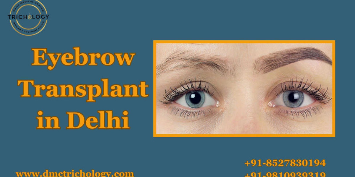 Restore Your Natural Look with Eyebrow Transplant in Delhi