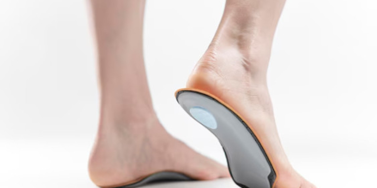 Customised Insoles: A Step Towards Better Foot Health