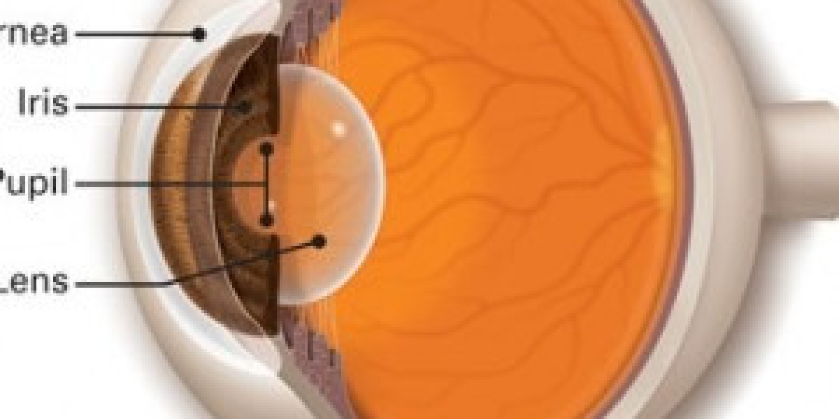 Cornea Transplant in Delhi: Restore Vision with Advanced Care