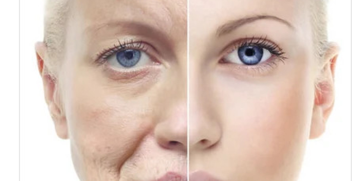 Mexico Anti-Aging Market Size, Share, Growth and Report 2024-2032