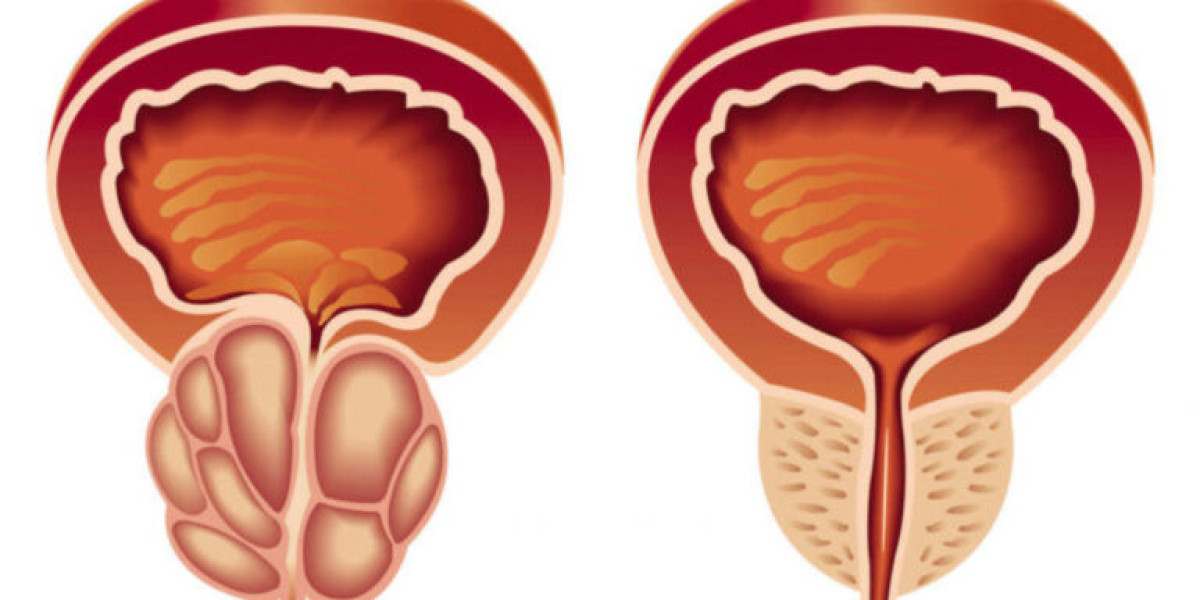 The Stuttering Market will grow at highest pace owing to increasing awareness and adoption of speech therapy