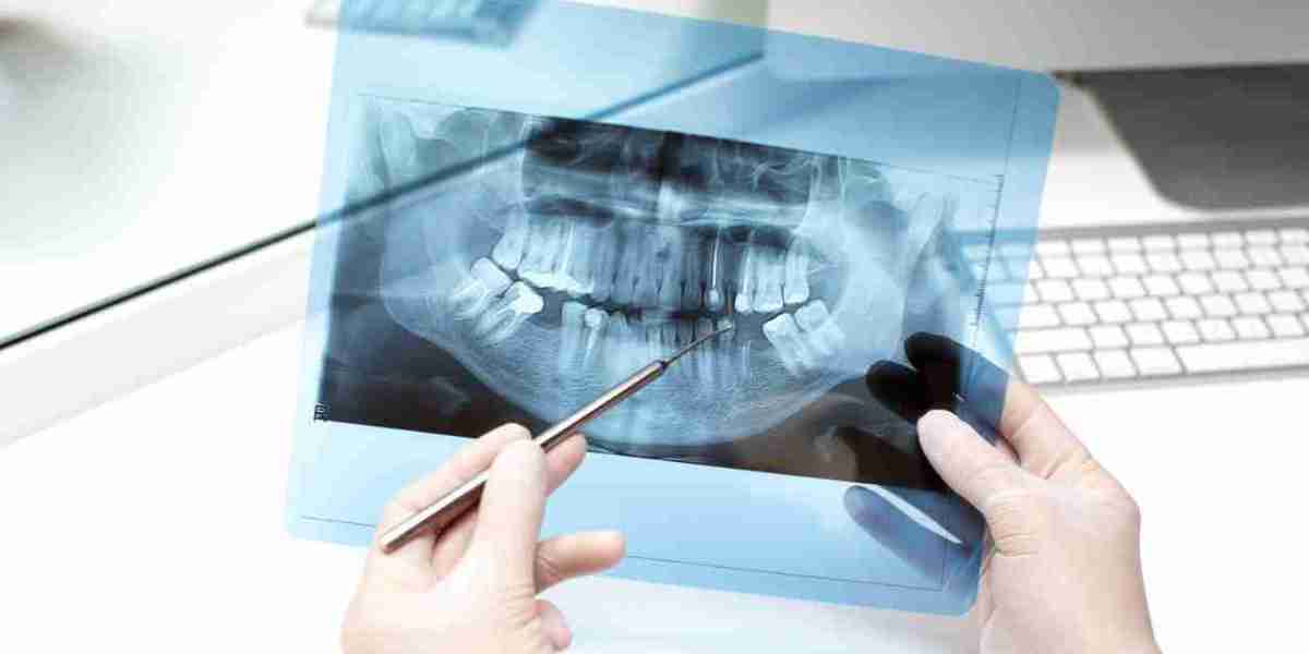 Types of Dental Radiology Services: Which One Do You Need?