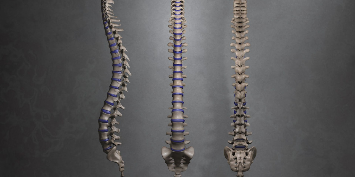 Rising Demand for Motion Preservation Spinal Devices Will Drive Growth in the Spinal Osteosynthesis Units Market